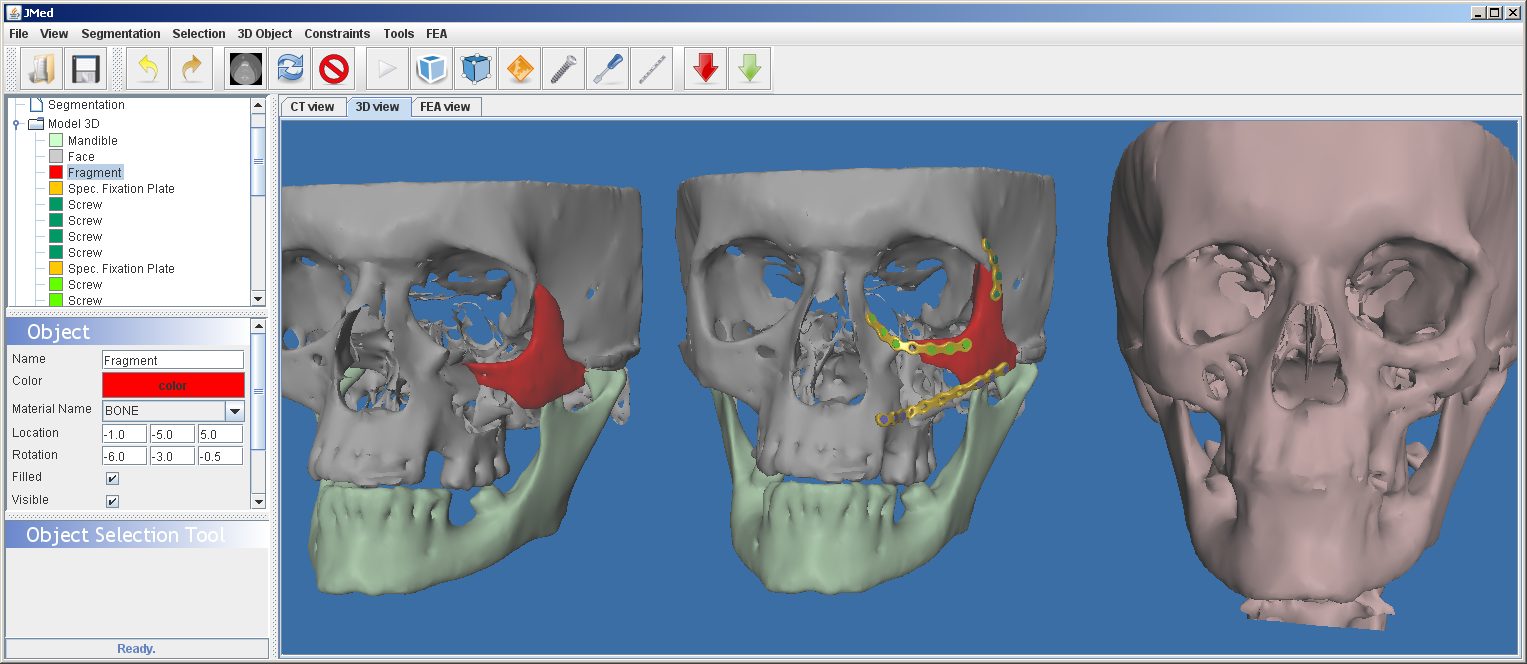 MedSyS